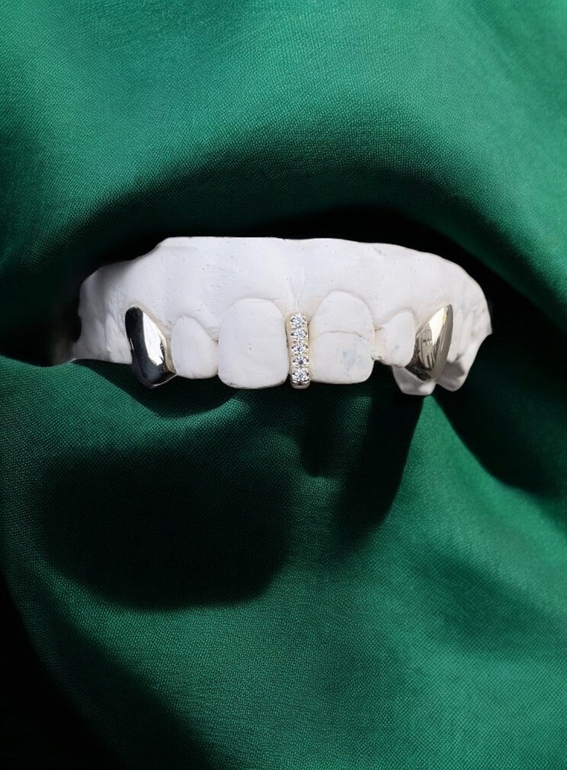 Diamond Gap Filler