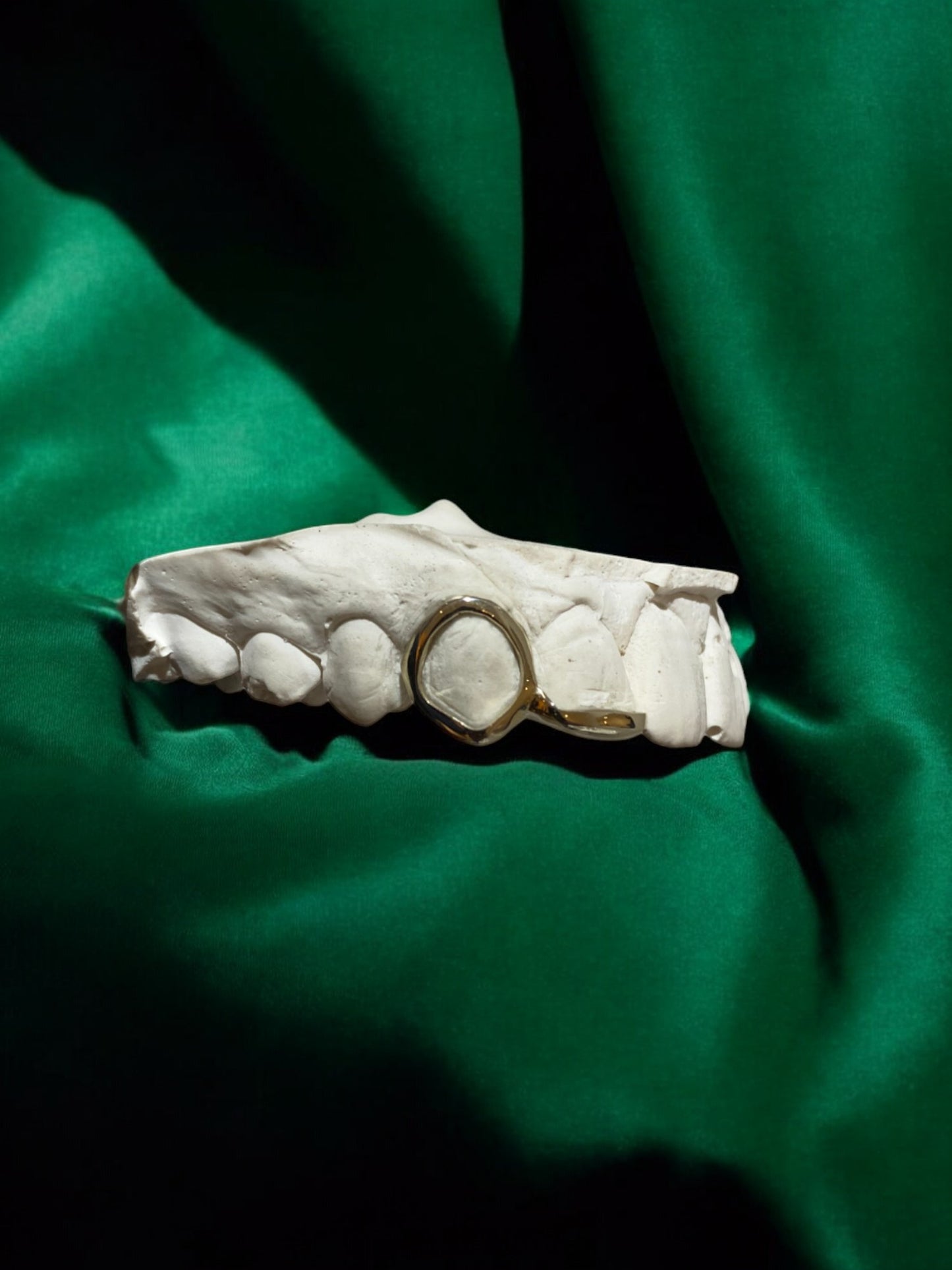 Window + Inlay, Silver, Gold