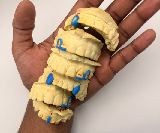 How Are Grillz Made? A Step-by-Step Look at the Custom Grillz Process