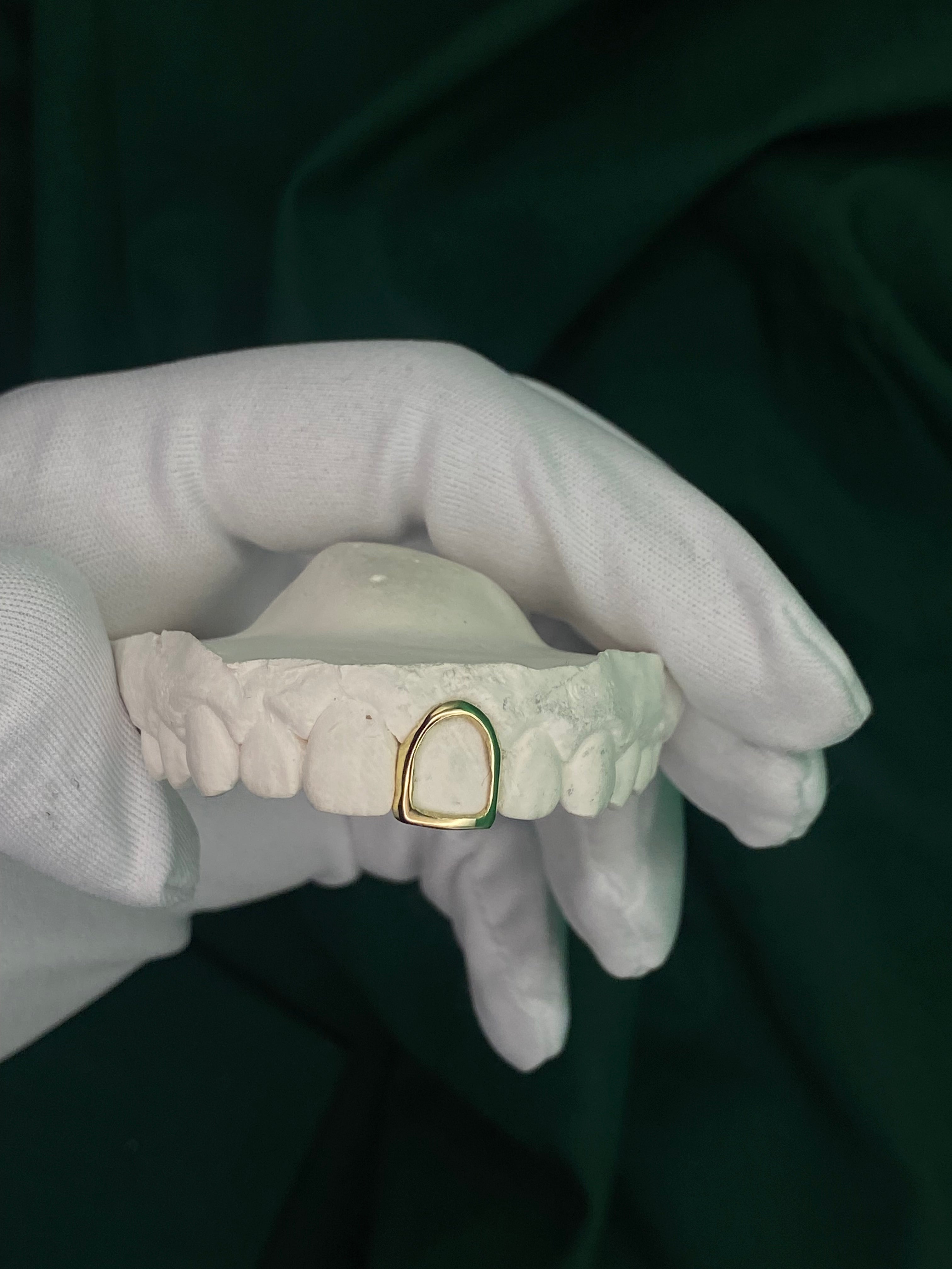 Custom Front Tooth Window Cap Grillz UK | Green Skull Grillz