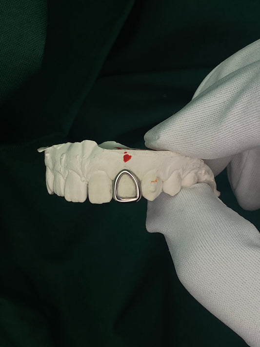 Lateral Incisor Window Cap