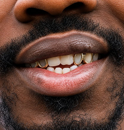 4 Window Caps | 4 Window Grillz, Silver, Gold