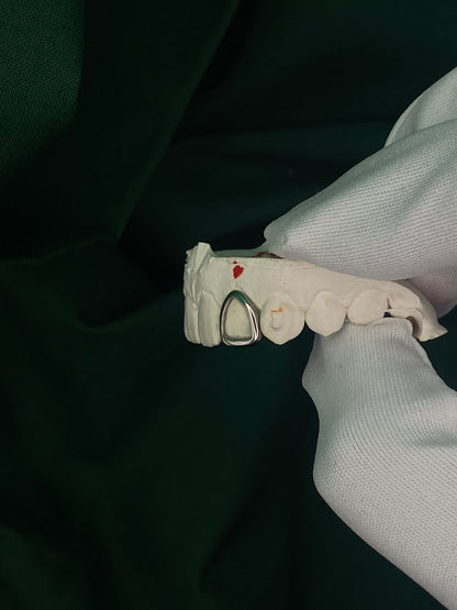 Lateral Incisor Window Cap