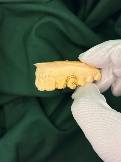 Gold double teeth swirl grillz made by Green Skull Grillz