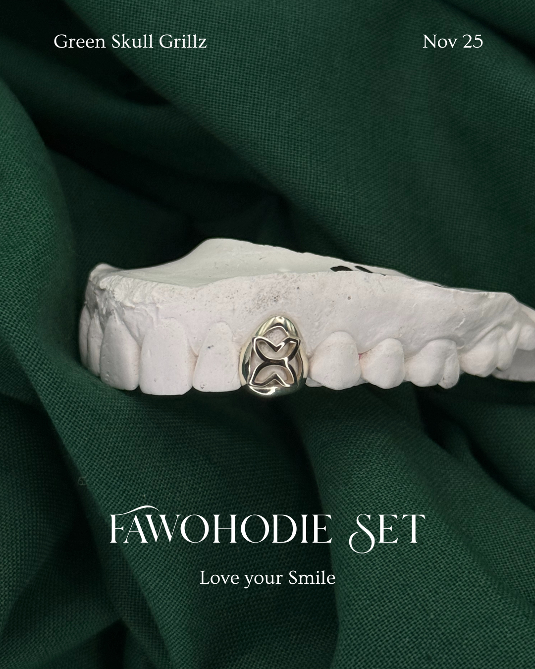 Custom white gold grillz by Green Skull Grillz