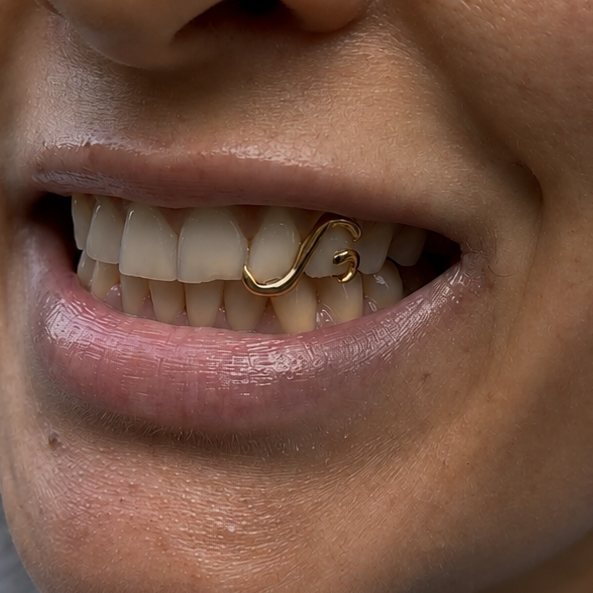 Double teeth custom swirl grillz on client made by Green Skull Grillz