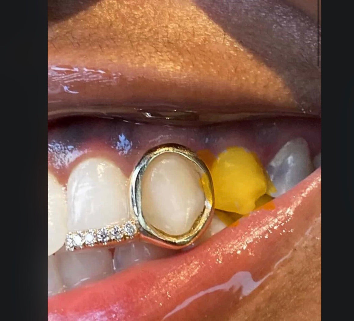 Solid + Window + Diamond inlay