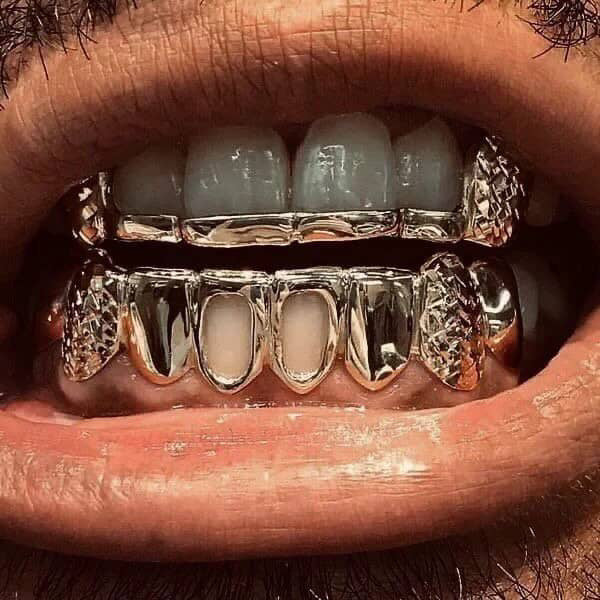 Custom Grillz