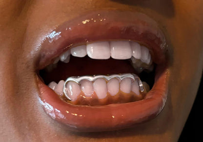 Custom Bottom 6 Set Grillz | Silver & Gold Grillz